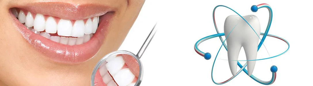 Porcelanske Fasete ili Viniri